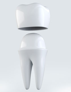 3D illustration of crown tooth