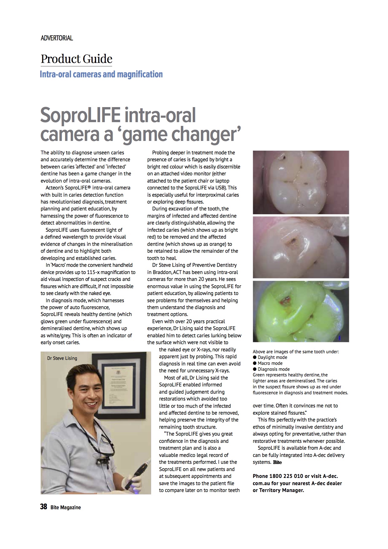 Article featuring Dr Steve Lising published in Bite Magazine